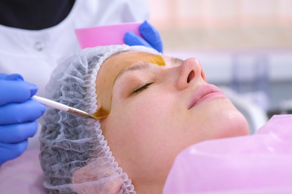At what Age Should You Start Getting Chemical Peels