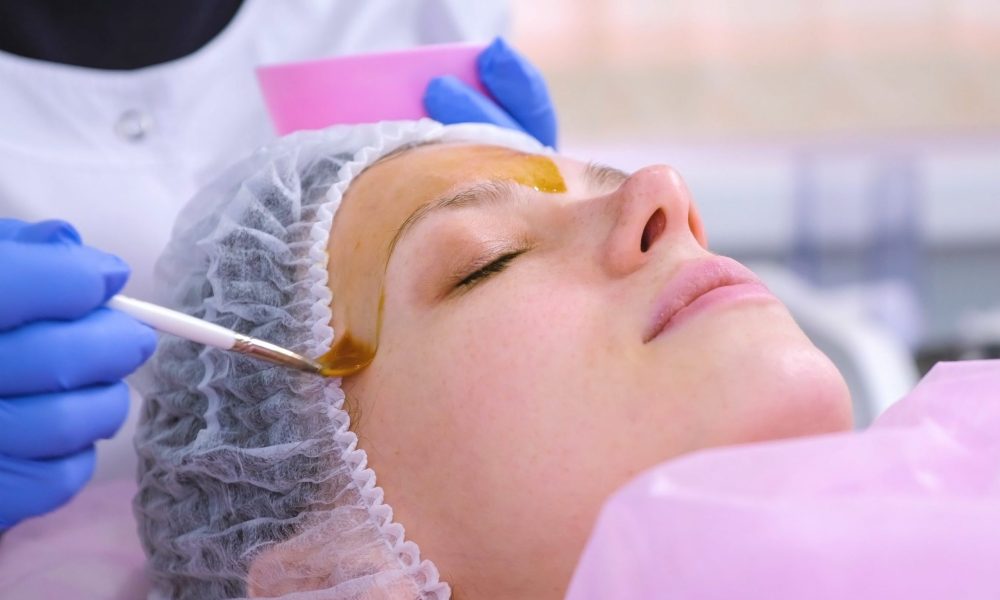 At what Age Should You Start Getting Chemical Peels
