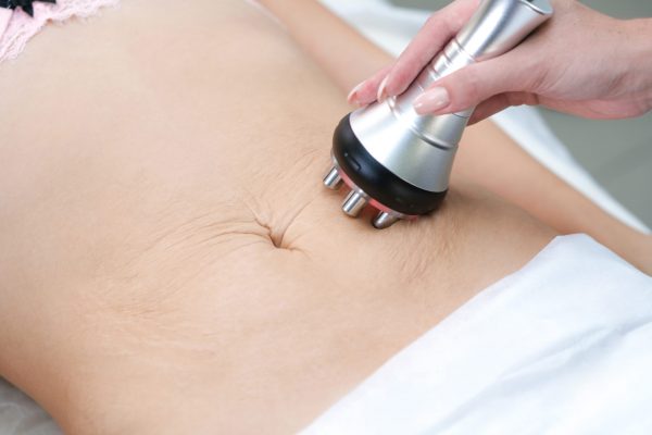 Body Sculpting Radio Frequency Therapy in Las Vegas by Skinetic